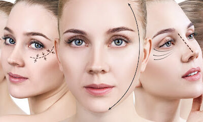 Fibroblast plasma lift