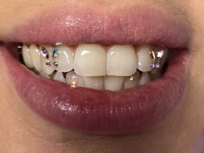 Exotic Beauty Labs and Tooth Gems