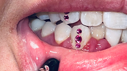 Tooth gems by marlins