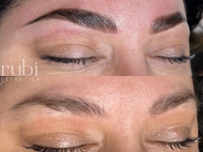 Rubi Esthetica