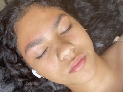 Bareskin Esthetics
